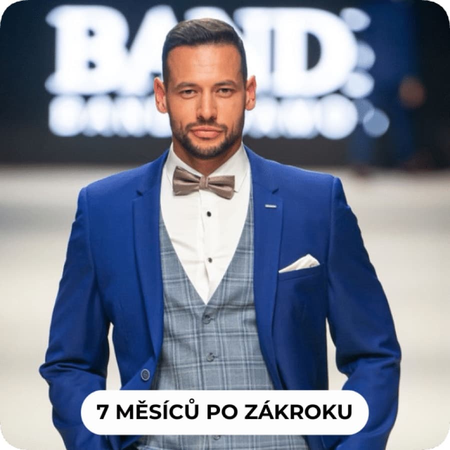 7 měsíců po zákroku