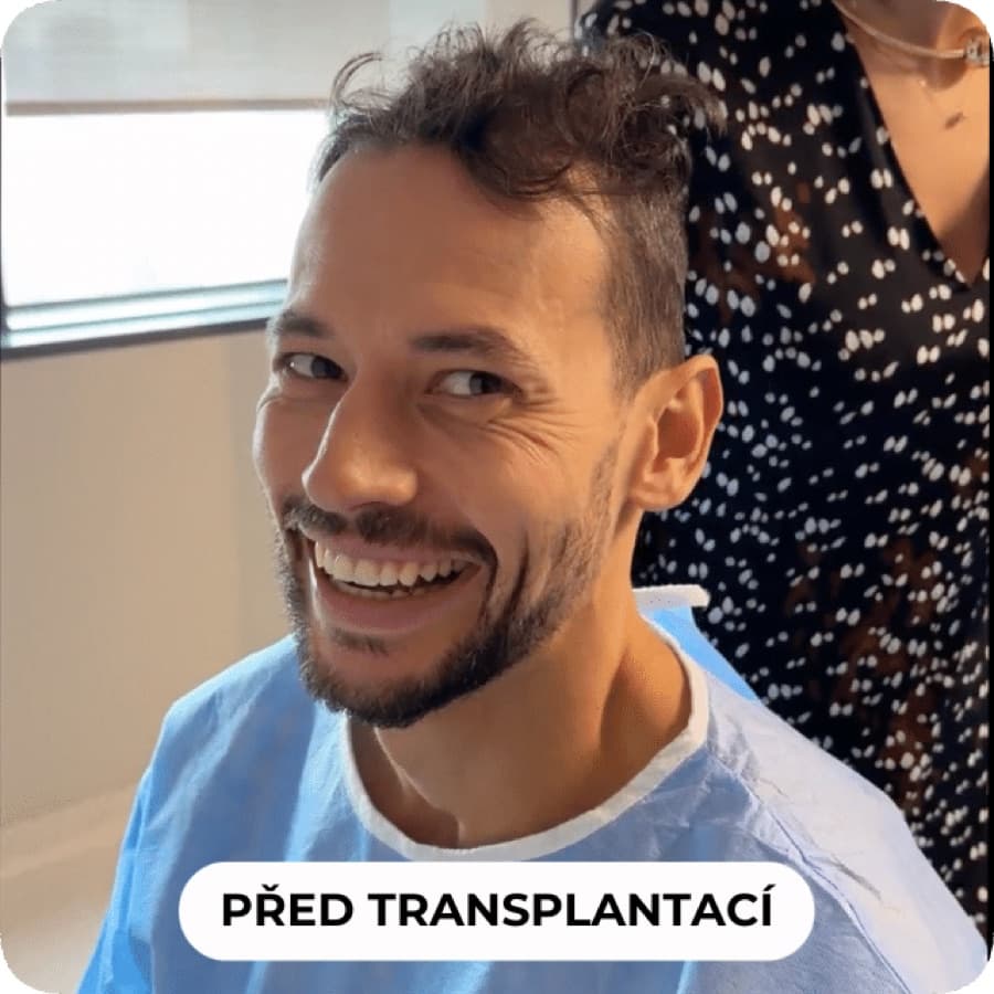 Před transplantací