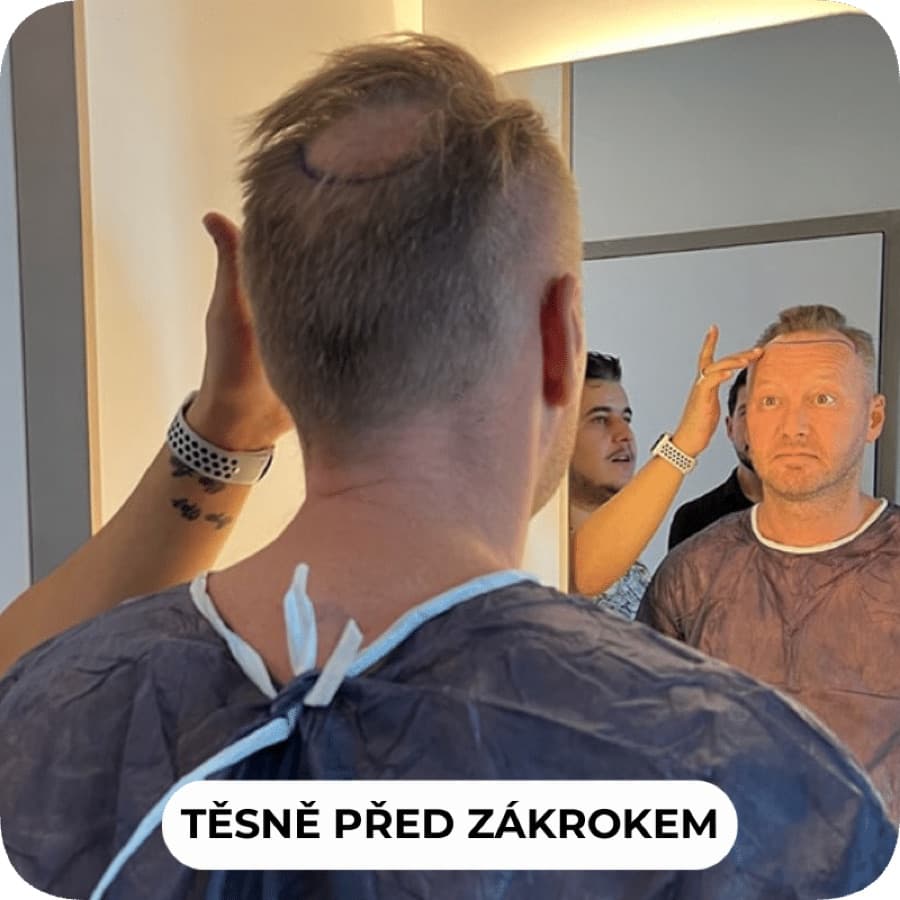Těsně před zákrokem